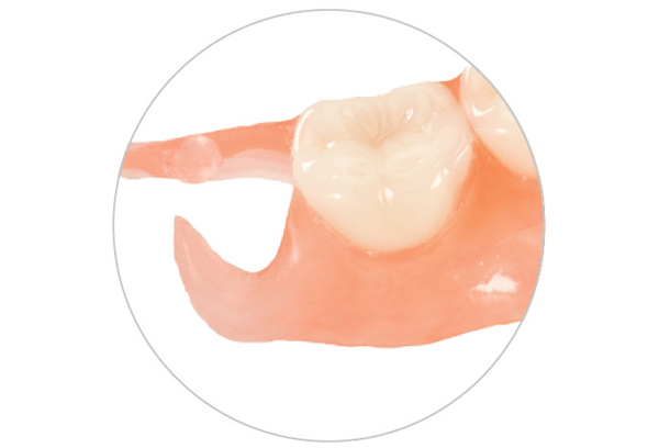 clasp_option_tissue Tissue Colored