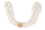 Essex Retainer