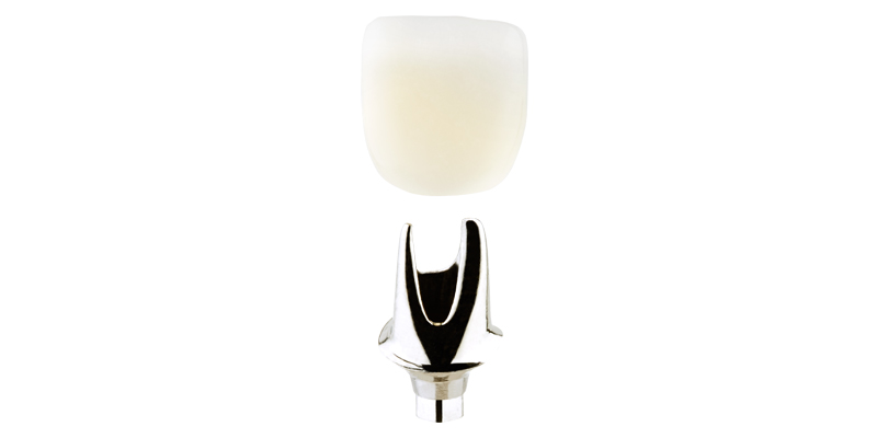 dc_imp_customtempabutment Custom Temporary Abutment & Crown