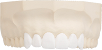Diagnostic Wax-Up