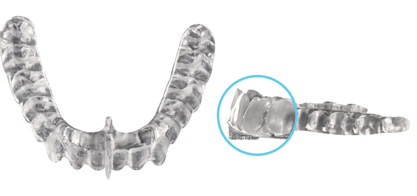 Image_DCN_Full Occlusal Deprogrammer for web