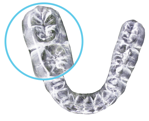 Image_DCN_Spears Anatomical Occlusal for web
