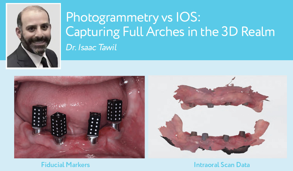 Photogrammetry versus IOS_Dr. Tawil